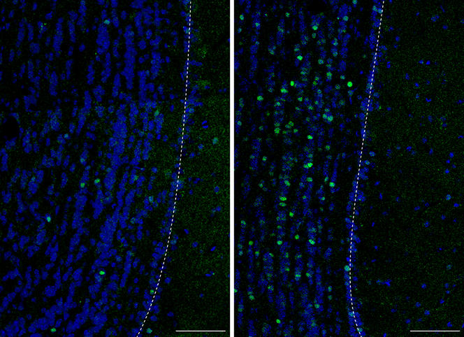 ©Gabriel Lepousez / Institut Pasteur - CNRS.