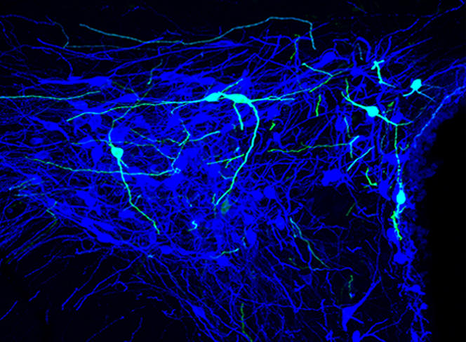 ©Alexander CHARLET / Valery GRINEVICH / INCI / DKFZ / CNRS Photothèque